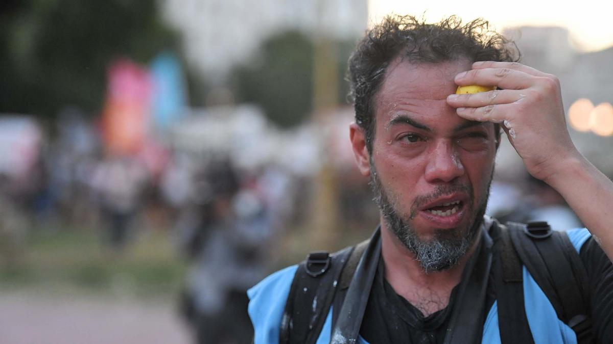 Alfredo Luna uno de los reporteros grficos de Tlam que resultaron heridos Foto Vctor Carreira