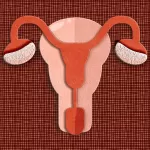 5 signos de síndrome de ovario poliquístico que podrías estar confundiendo con otra cosa