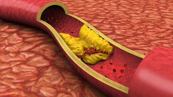 El té disminuye el colesterol malo y limpia las arterias.