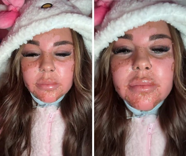 La británica tuvo que recibir atención médica. Foto: captura de video/TikTok.