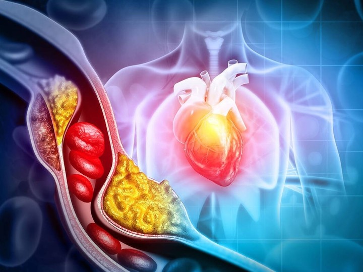 El tomate disminuye el colesterol LDL protege  contra las enfermedades cardiovasculares. 