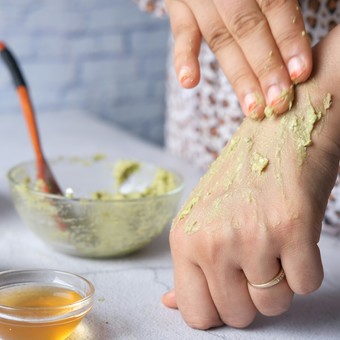 Chau a las cremas: el truco de cocina para aliviar las quemaduras del sol