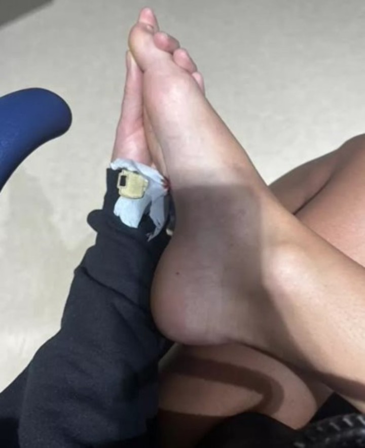 La joven pisó un pantalón y se clavó las llaves que tenía en el bolsillo.  Foto: Madison Martin