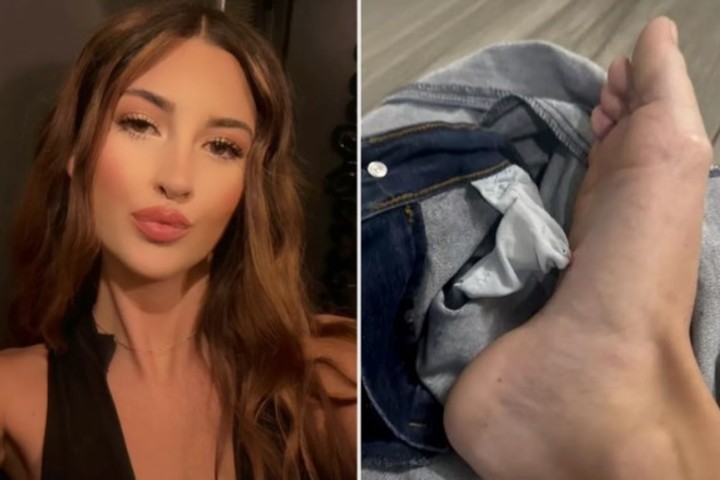 Madison iba al baño cuando pisó un pantalón que había dejado tirado en el piso. A partir de allí, todo fue peor.