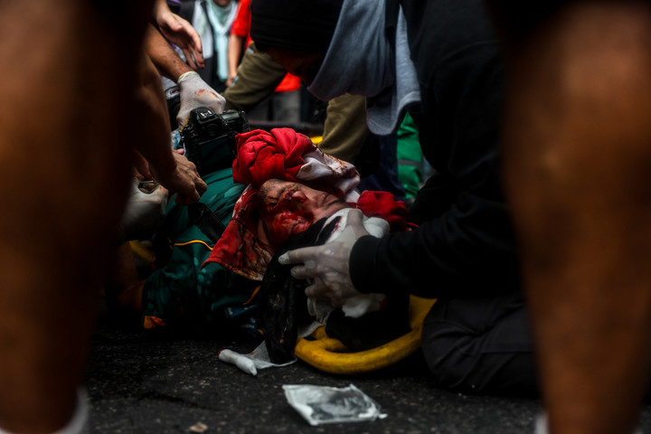 Pablo Grillo, el fotógrafo herido en la marcha del miércoles. Foto Cristina Sille 