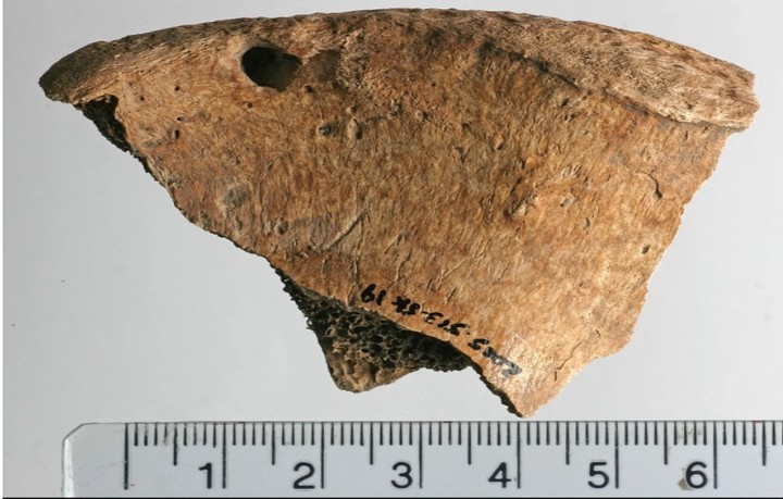 Lesiones en la espina ilíaca izquierda de 6DT19“Evidencia osteológica única de combate de gladiadores entre humanos y animales en la Britania romana. Foto: Thompson TJU, Errickson D, McDonnell C, Holst M, Caffell A, Pearce J, et al., en PLoS ONE, vol. 20, n.º 4, artículo n.º e0319847, publicado online el 23 de abril de 2025.