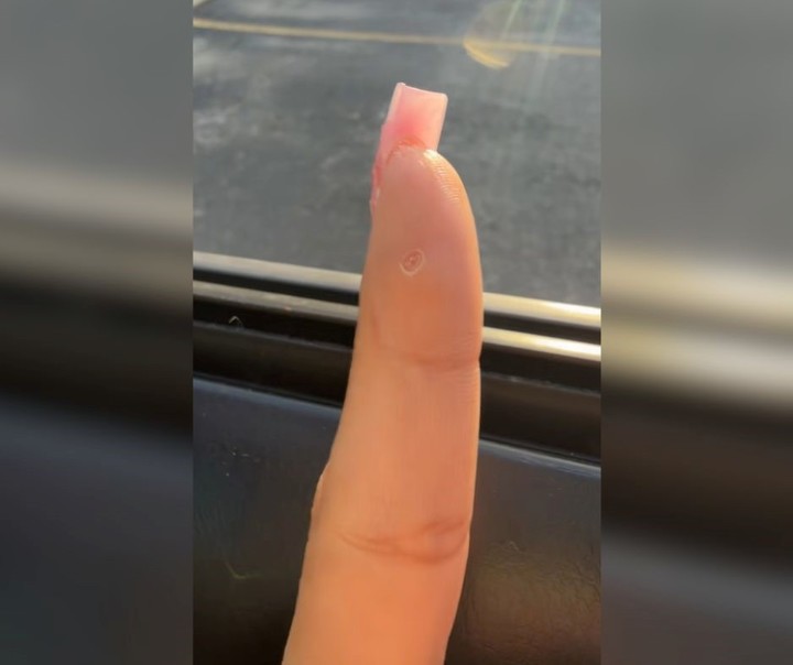 Así quedó su dedo, curado, tiempo después de haber quitado el trozo de vidrio. Foto: captura de video/TikTok @c.marie777.