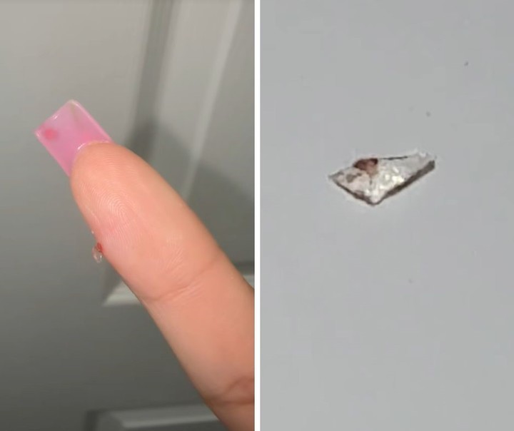 En la primera imagen, el presunto trozo de vidrio sobresale de su dedo. La segunda imagen corresponde al trozo de vidrio, captado con mucho zoom.