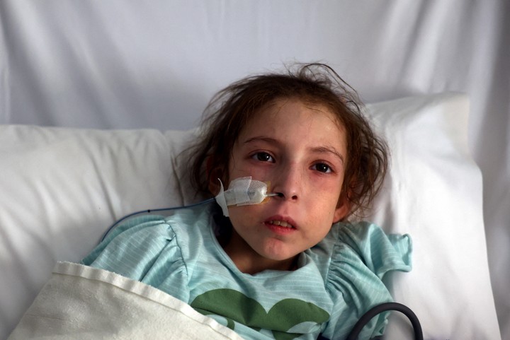 Rahaf Ayyad, 12, de Gaza recibe tratamiento por desnutrición en Abu Dhabi. Foto: Reuters 