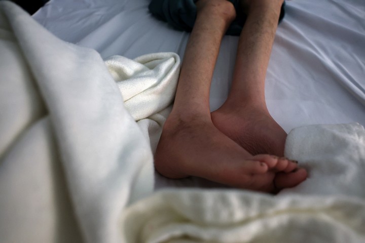 Desnutrición en una niña palestino de 12 años. Foto: Reuters
