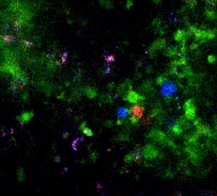 Tejido linfático de ratón con células inmunitarias inductoras de tolerancia oral, en verde, rojo y azul.