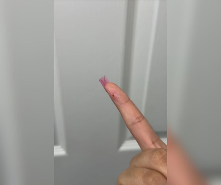 La estadounidense empezó a sentir un bulto en el dedo índice. Foto: captura de video/TikTok @c.marie777.