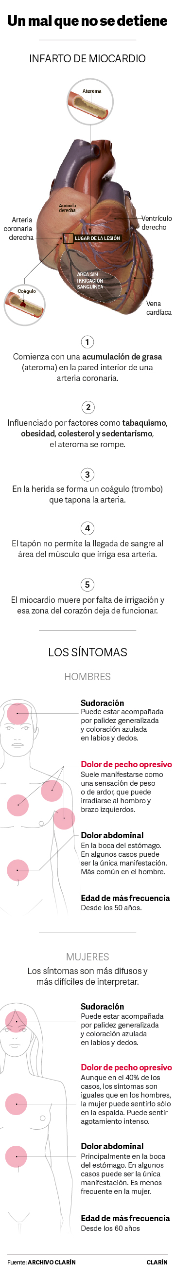 infarto-miocardio