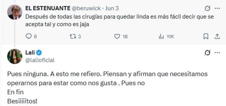 Lali negó haberse hecho retoques estéticos. Foto: X