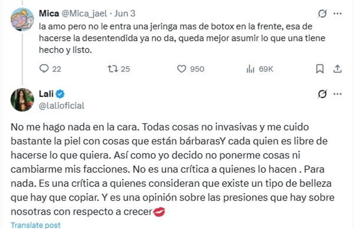 El enojo de Lali Espósito contra quienes la acusaron de haberse hecho retoques estéticos. Foto: X