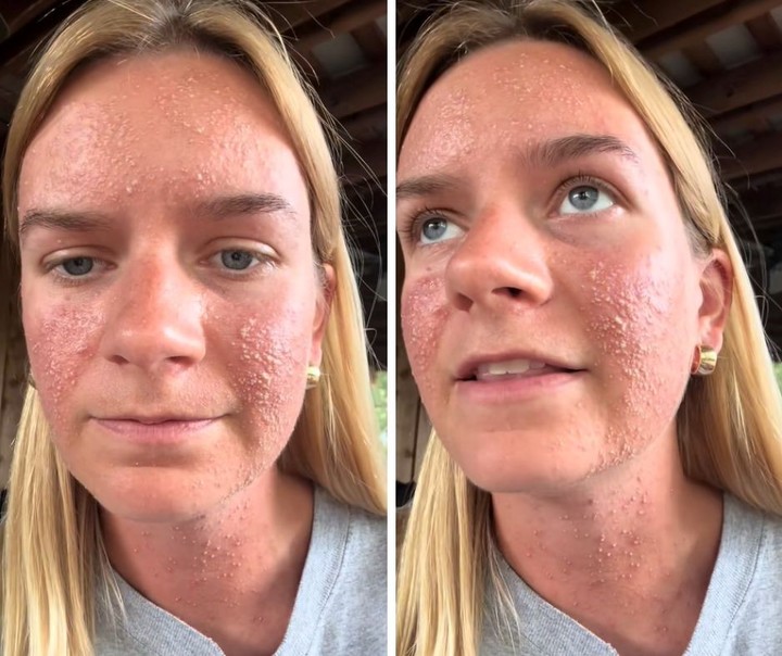 Así tenía la cara la joven. Foto: captura de video/TikTok @sarahtneal.
