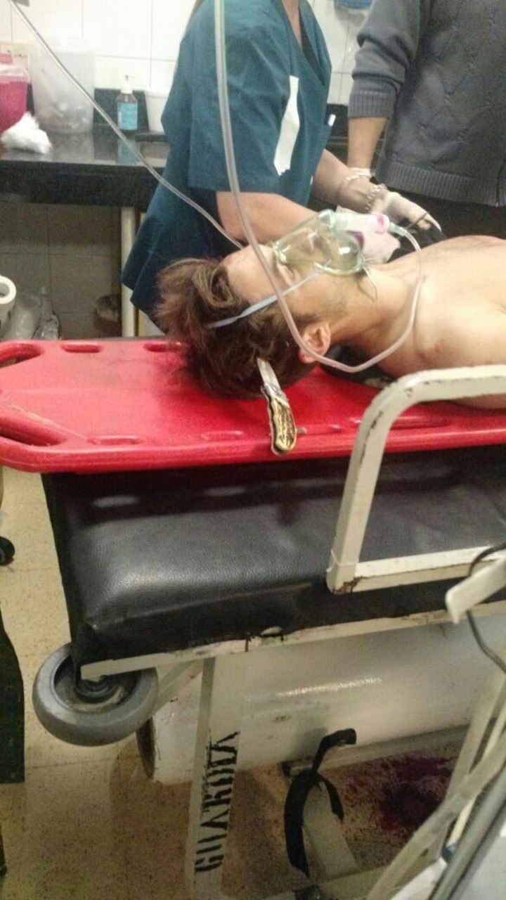 Bonetto fue trasladado a un hospital con su propio cuchillo clavado en la cabeza. 