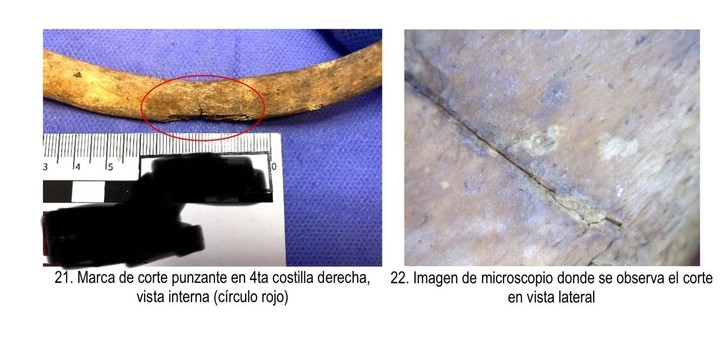 La cuarta costilla derecha de los restos tiene la marca de un puntazo.