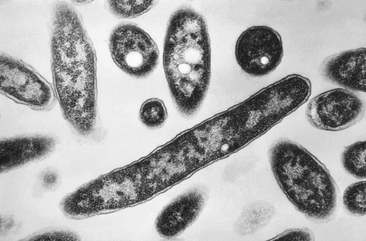 La enfermedad del legionario afecta principalmente a personas mayores o con condiciones de salud preexistentes. (Francis Chandler/CDC via AP, File)