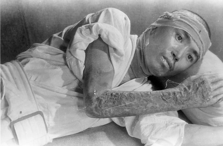Un hombre en un hospital militar de Hiroshima en octubre de 1945. Foto Shunkichi Kikuchi, cortesía de Harumi Tago.