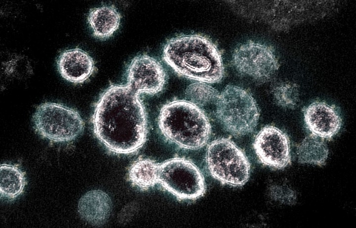 Una imagen del virus del Covid en un microscopio electrónico. Foto: AFP